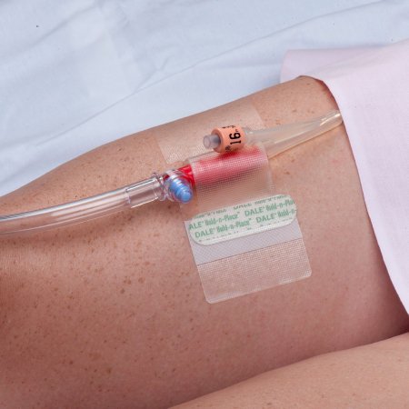 Catheter Holder Hold-n-Place® One Size Fits All, Adhesive Patch