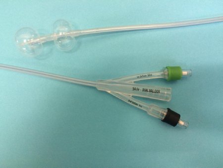 Foley Catheter Duette™ 2-Way Subsumed Tip 10 cc Proximal Balloon, 5 cc Distal Balloon 14 Fr. Silicone
