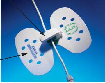 Catheter / Line Securement Device Statlock® Universal Plus