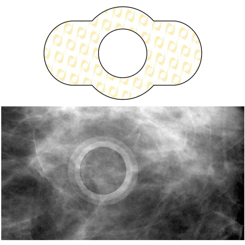 Spee-D-Ring™ Skin Marker