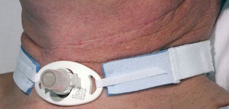 Tracheostomy Tube Holder AirLife® Neonatal / Pediatric