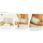 Mepore® Adhesive Dressing, 2.5 x 3 Inch