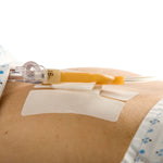 Cath-Secure™ Holder, Tube