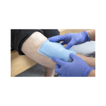 Mextra® Superabsorbent Dressings, 9 x 13 Inch