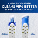 Oral-B® Vibrating Pulsar™ Battery Toothbrush Expert Clean Soft