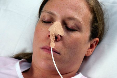 Nasogastric Tube Holder Dale® One Size Fits Most Adult Patients