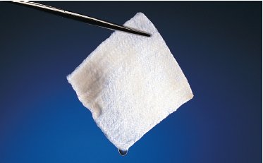 Silver Alginate Dressing Sorbalgon® Ag 2 X 2 Inch Square Sterile